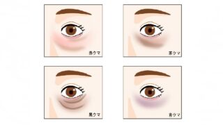 『目の下のクマ』が気になる年頃？　原因に合った対策を！